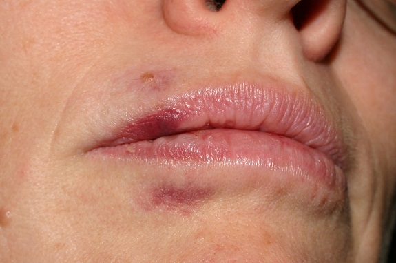 Violencia Intrafamiliar