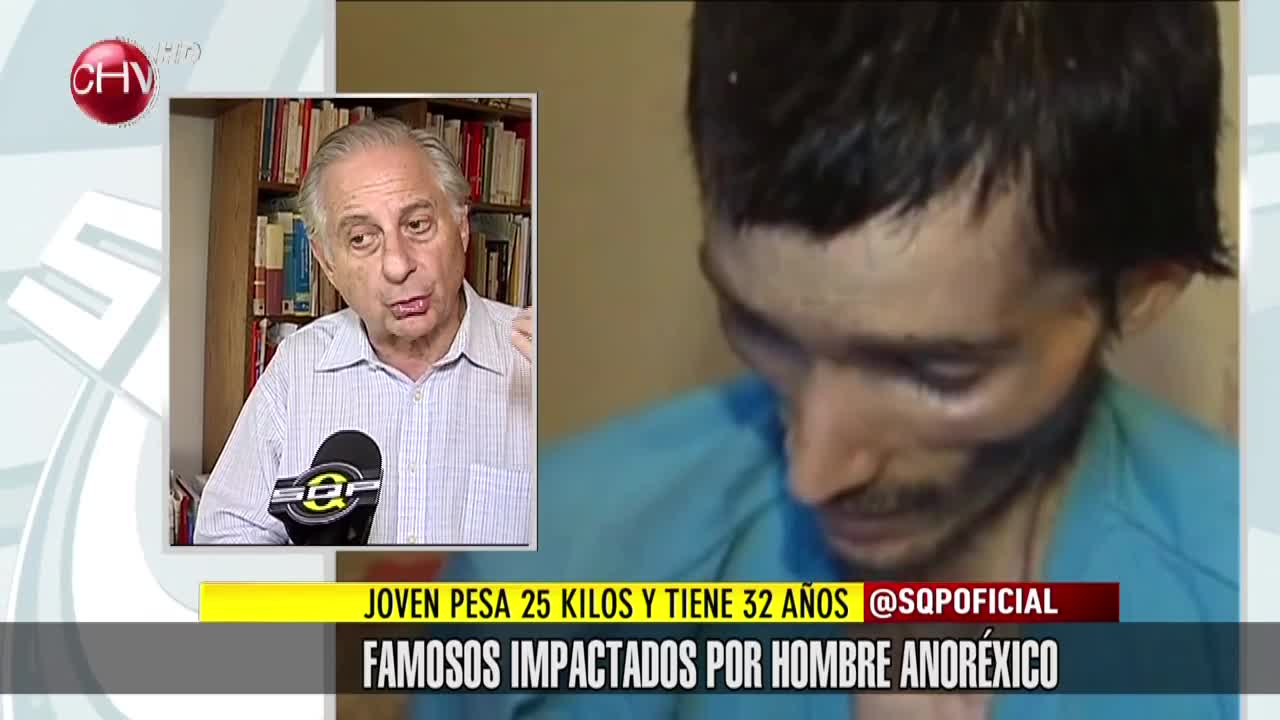 Famosos impactados por caso de joven anoréxico