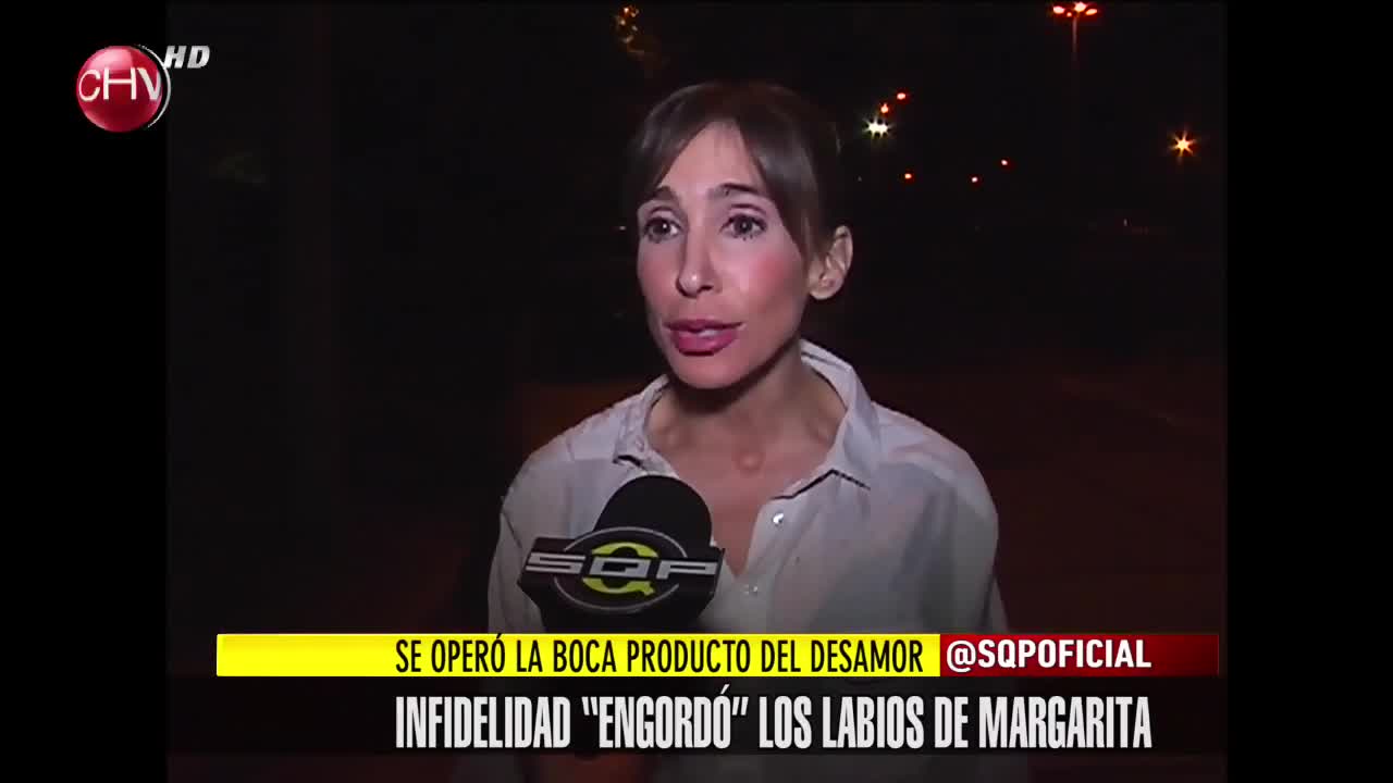 Margarita Hantke se operó sus labios tras sufrir decepción amorosa