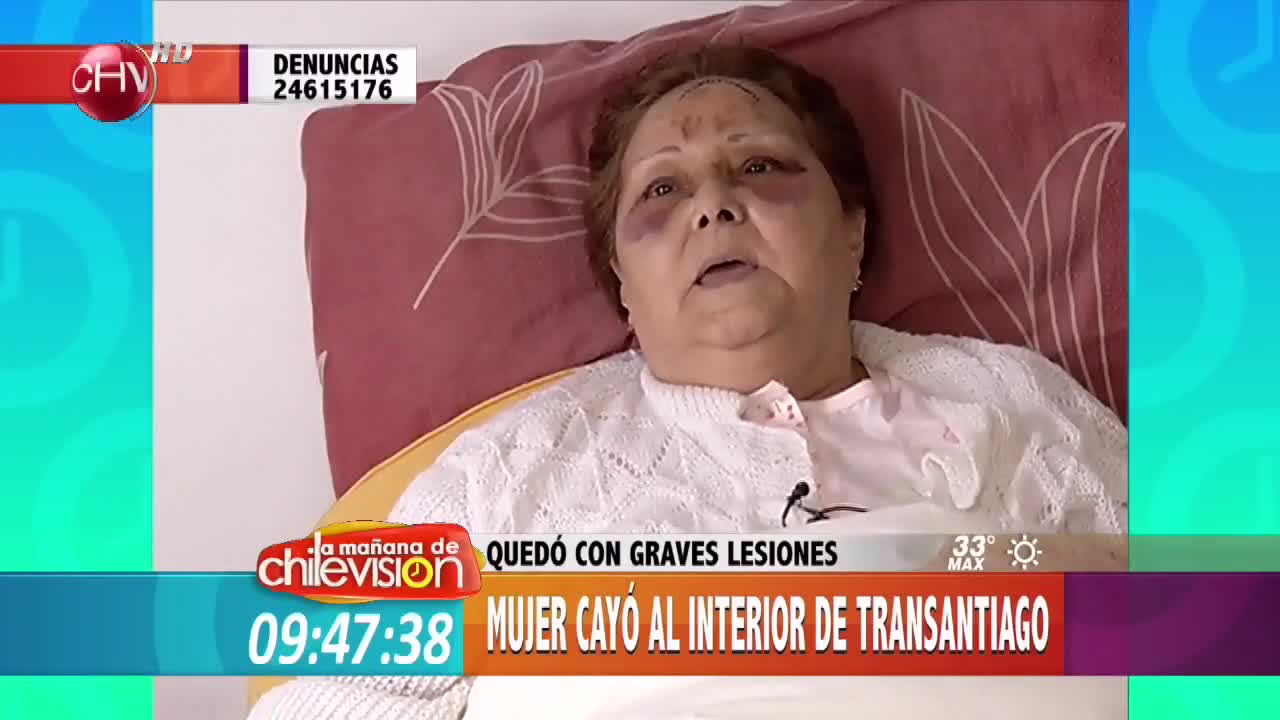 Mujer pide justicia tras caer en bus Transantiago y quedar con lesiones graves