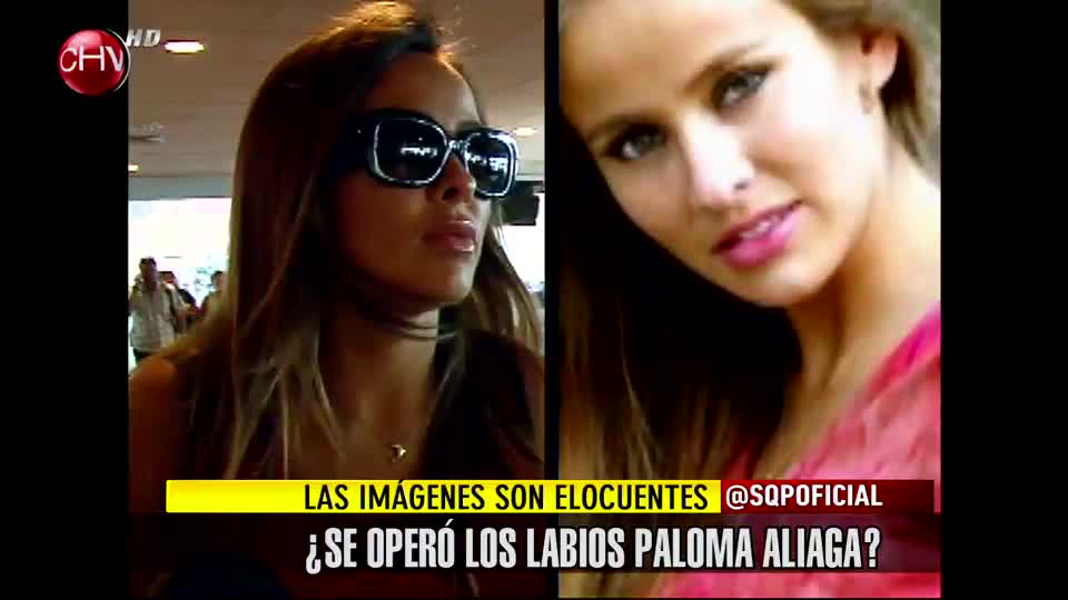 ¿Se operó los labios Paloma Aliaga?
