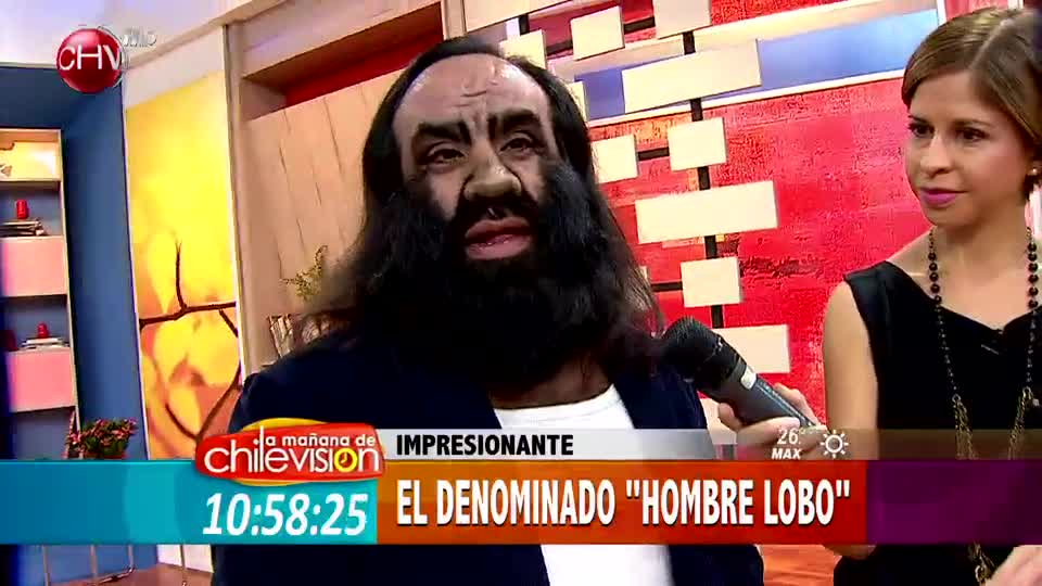 Hombre lobo, el más alto y más pequeño del mundo estuvieron en La mañana de CHV