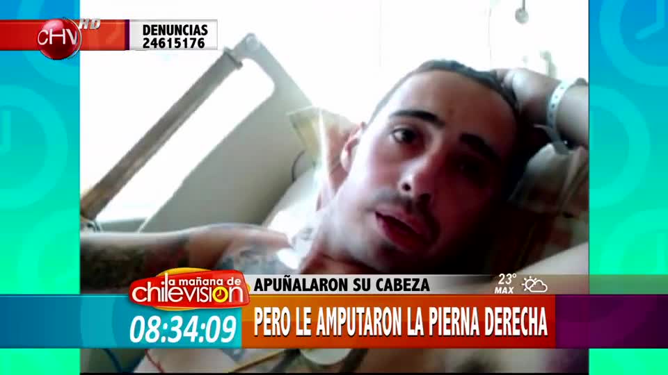 Lo apuñalaron en su cabeza pero le amputaron la pierna
