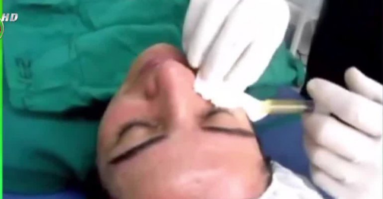 Famosos y el Boom de las intervenciones estéticas