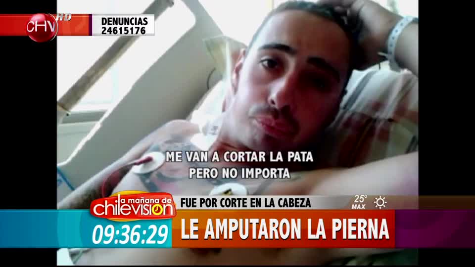 Iba por un dolor de cabeza y le amputaron la pierna