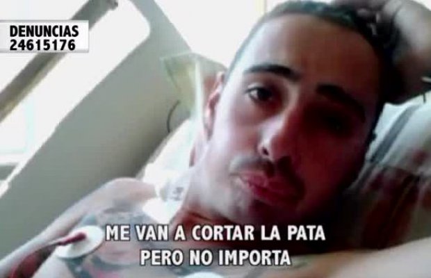 Iba por un dolor de cabeza y le amputaron la pierna