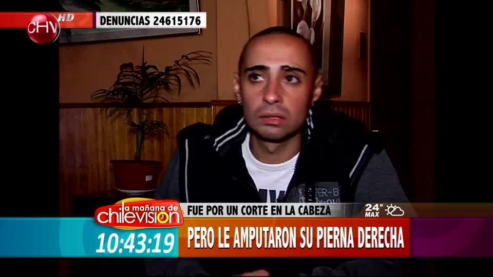 Testimonio del joven que por error le amputaron una pierna