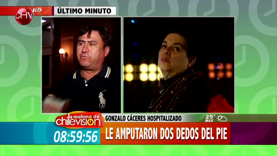 Gonzalo Cáceres debió ser amputado de sus dedos del pie producto de la diabetes