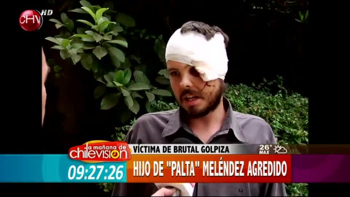 Hijo del “Palta” Meléndez fue golpeado por desconocidos