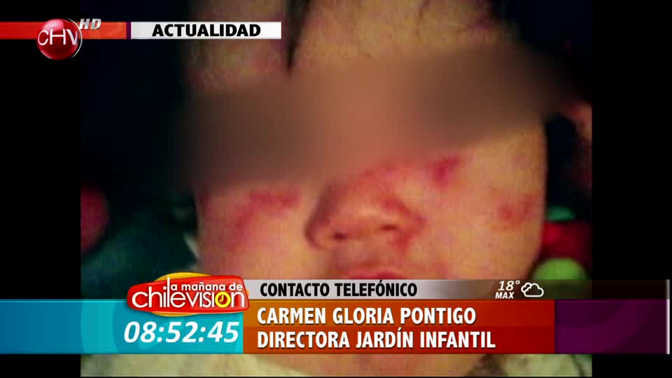 Madre denuncia agresión en el jardín a menor de un año