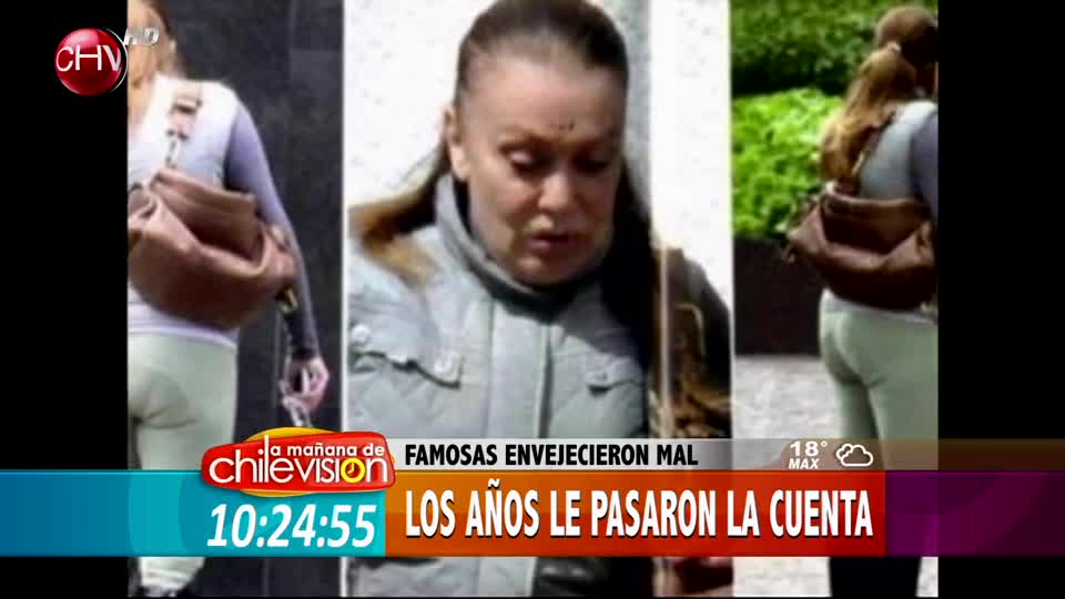 Años que juegan en contra: Famosas que envejecieron mal