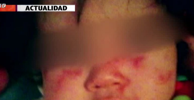 Madre denuncia agresión en el jardín a menor de un año