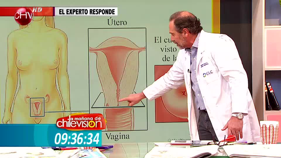 El ginecólogo Rafael Silva explicó lo que significa el examen del Papanicolaou (Parte 1)