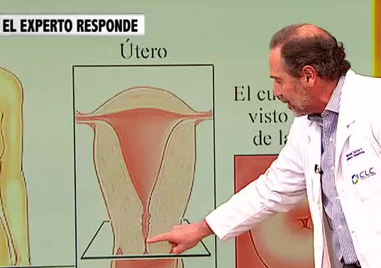 El ginecólogo Rafael Silva explicó lo que significa el examen del Papanicolaou (Parte 3)