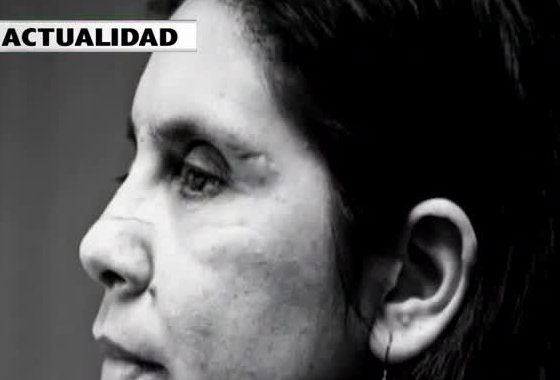 Conoce la historia de la mujer que le arrancaron los ojos por celos