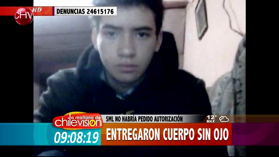 Familia denuncia que SML entregó el cuerpo sin un ojo de su hijo