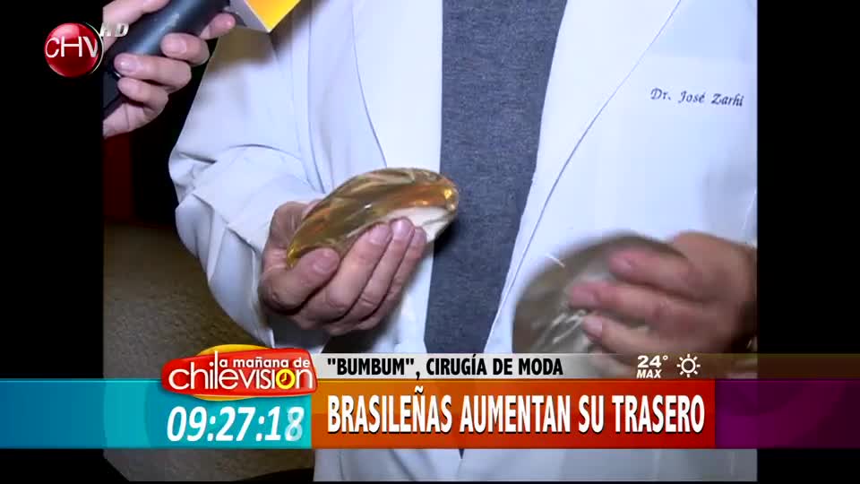 Conoce por qué los traseros de las brasileñas causan tanta sensación