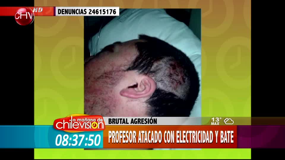 Profesor fue atacado con bate y electricidad por guardias de un pub