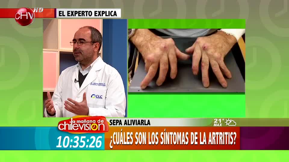 Conozca a fondo todo sobre la Artrosis y la Artritis (Parte 1)