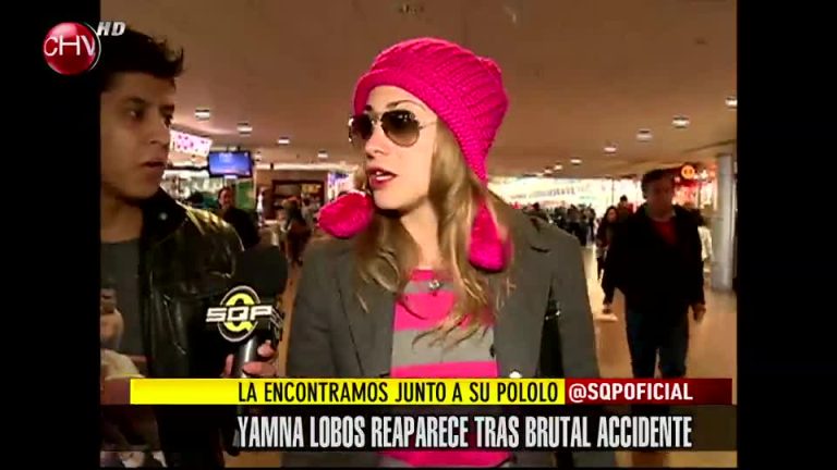 ¡Vimos a Yamna Lobos a 8 días de su accidente!