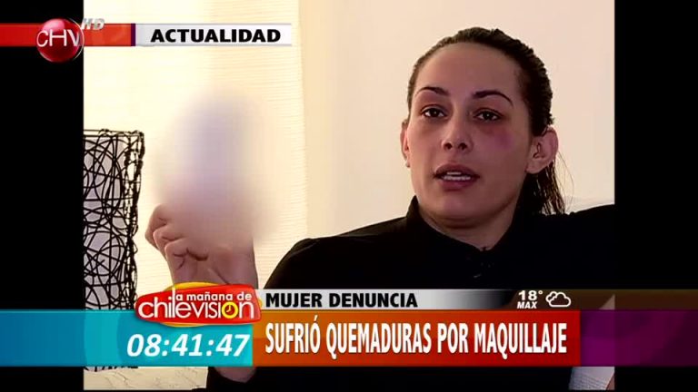 Mujer denuncia haber sufrido quemaduras por una crema para el rostro