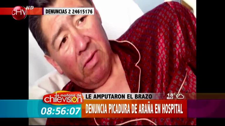 Hombre denuncia que le amputaron un brazo por la mordedura de una araña