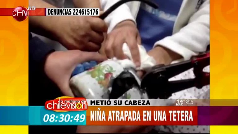 Insólito: Niña atrapa su cabeza al interior de una tetera