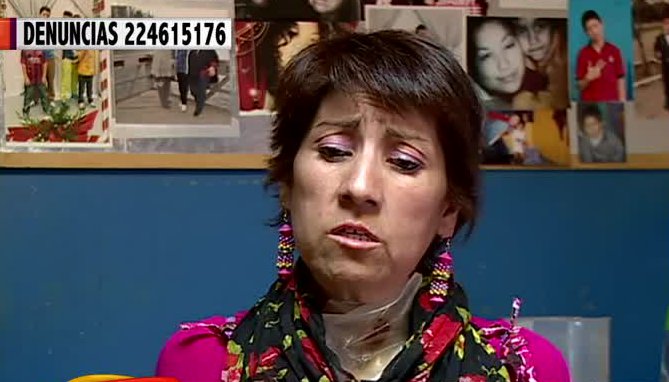 ¡Impactante! Mujer fue por un ahogo y ahora no puede comer