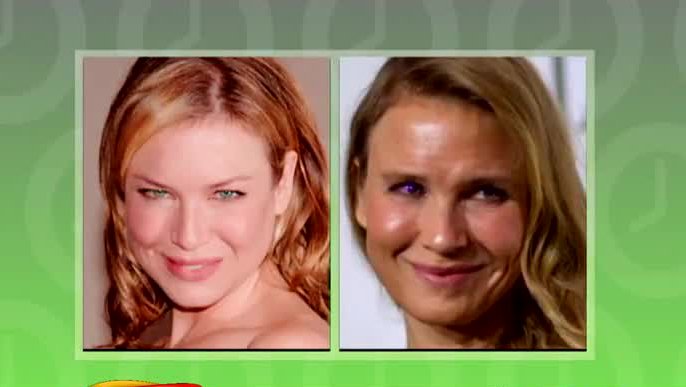 Actrices que abusaron de las cirugías y sufrieron cambios rotundos