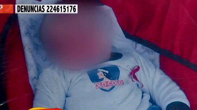 Bebé de 4 meses es operado por error de una hernia inguinal