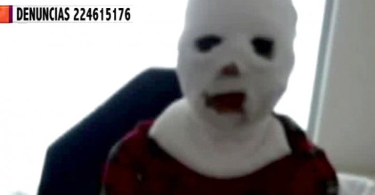 Joven se quemó cara, brazos y manos tras intentar cocinar churros en su colegio