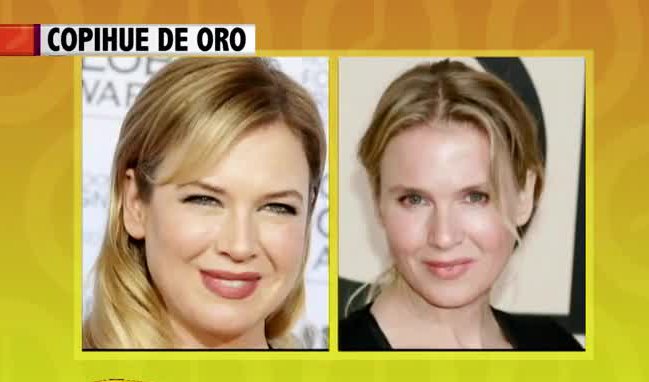 Famosas que quisieron combatir la vejez con cirugías y arruinaron su rostro