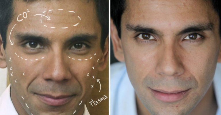 El antes y el después de Juan Pablo Queraltó