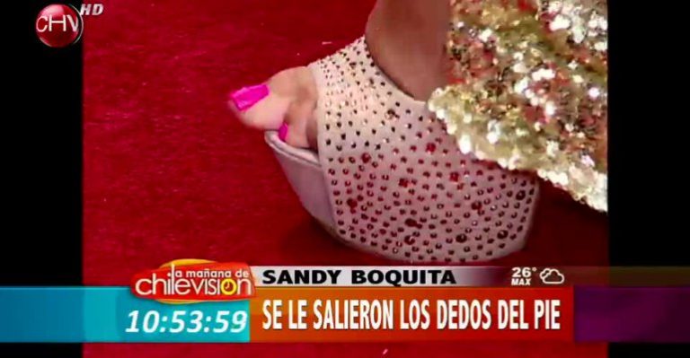 Sandy Boquita y sus dedos de los pies se llevaron las miradas en el Copihue de Oro