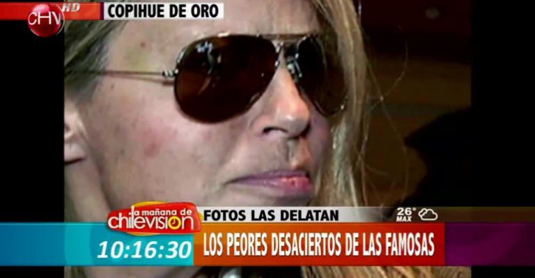 Fotos que delatan los peores desaciertos de las famosas