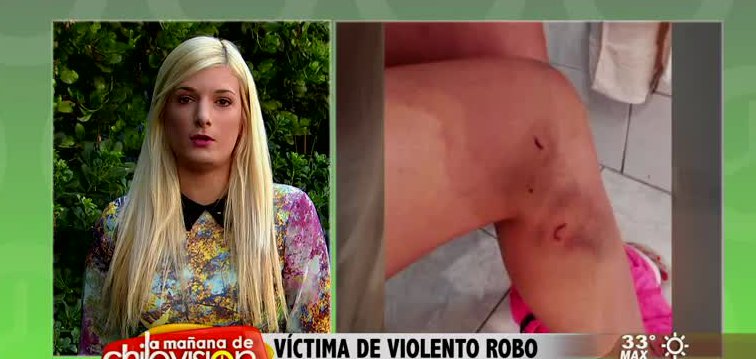 DJ argentina fue apuñalada en las piernas tras asalto