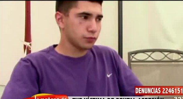Joven denuncia que fue golpeado por un hecho que no cometió