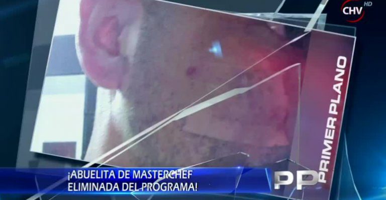 El grave y oculto accidente de participante de Master Chef durante las grabaciones
