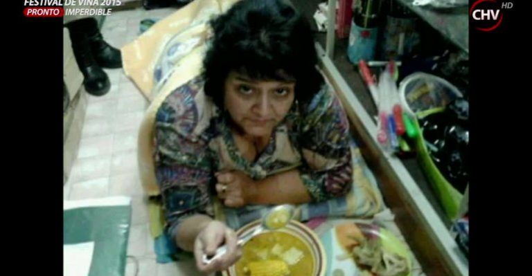 Mujer que fue a urgencia por orzuelo lleva dos años con muletas y denuncia negligencia