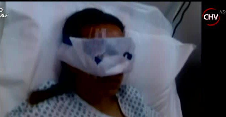 Fue formalizado peluquero acusado de brutal agresión a joven