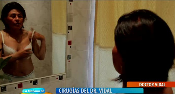 Mujer sufre porque no tiene senos