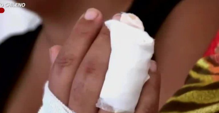 Iba por un dolor de espalda y terminó con un dedo amputado