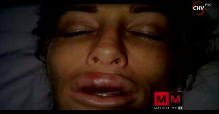 Cirugías en la boca es una de las 