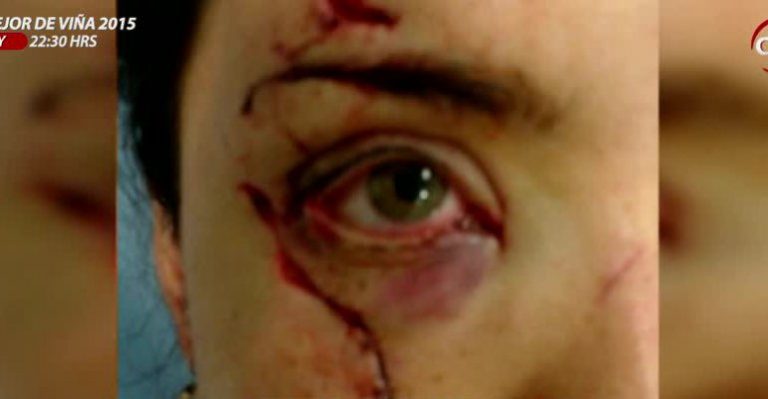 Mujer quedó con graves lesiones tras ser atacada con un vaso de vidrio