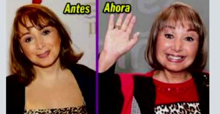 Cirugías de los famosos: ¿Vanidad o necesidad?