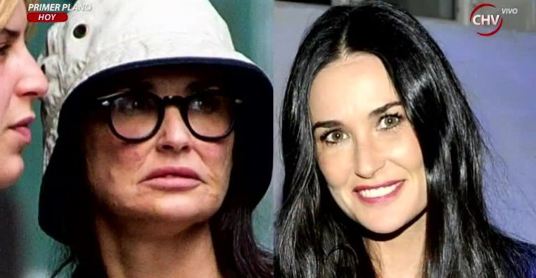 ¿Qué le pasó al rostro de la actriz Demi Moore?