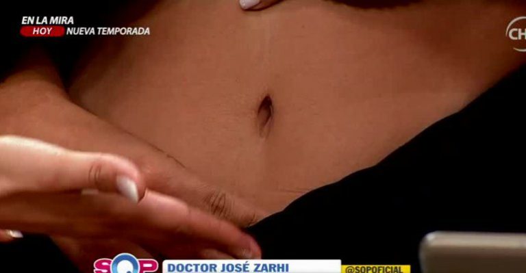 Cirujano echa al agua a famosas y revela quién se hizo operaciones