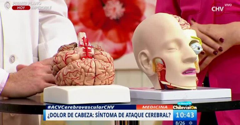 Neurólogo explicó detalles de los accidente cerebrovasculares - Parte 1