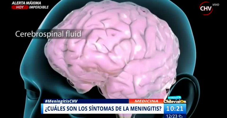 Todo lo que debe saber sobre la meningitis: síntomas, cómo se contagia y causas