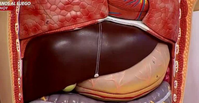 ¿Cómo detectar si tiene hígado graso y qué dieta debe seguir?